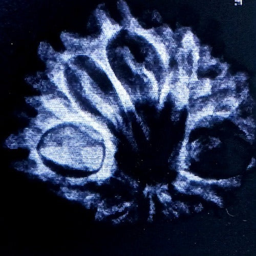 Rudraksha - 11 Mukhi | x ray 
