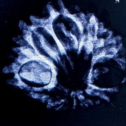 Rudraksha - 11 Mukhi | x ray 
